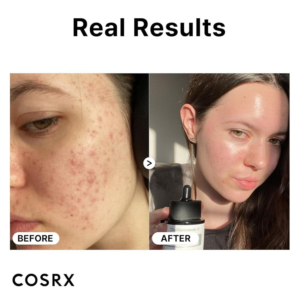 COSRX Sérum The Niacinamide 15 20 ml