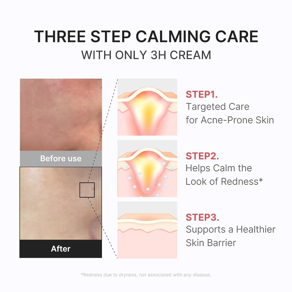Medicube Creme Calmante Hypochlorous 3H Relief 50 ml