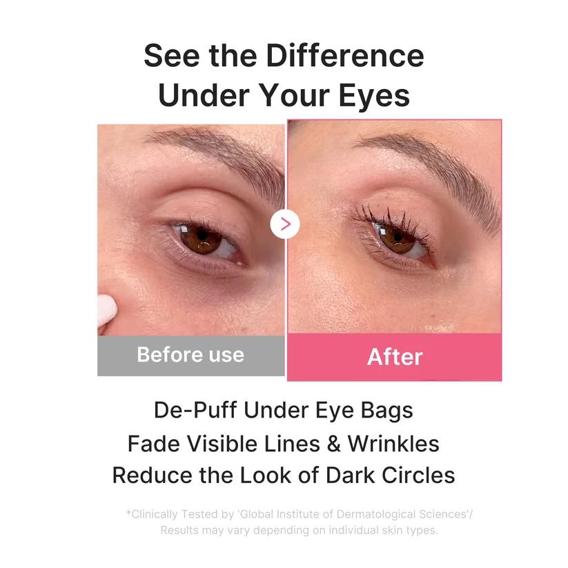 Medicube Máscara em Gel para Olhos PDRN Pink Collagen 6 pares